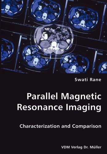 Parallel Magnetic Resonance Imaging Characterization and Comparison