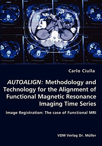 Autoalign Methodology and Technology for the Alignment of Functional Magnetic Resonance Imaging Time Series