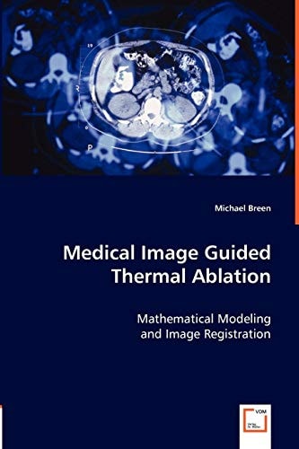 Medical Image Guided Thermal Ablation: Mathematical Modeling and Image Registration