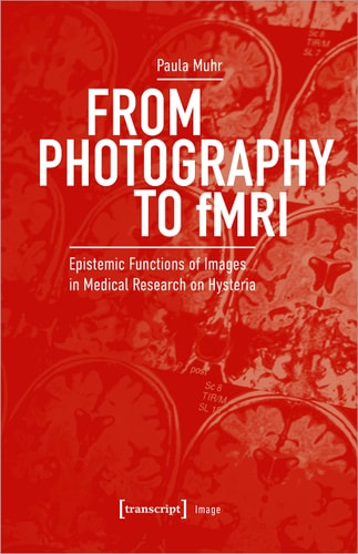 From Photography to FMRI Epistemic Functions of Images in Medical Research on Hysteria