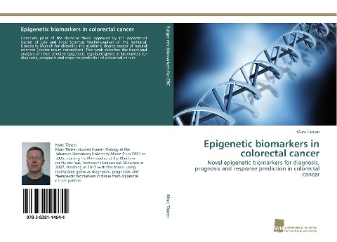 Epigenetic biomarkers in colorectal cancer: Novel epigenetic biomarkers for diagnosis, prognosis and response prediction in colorectal cancer