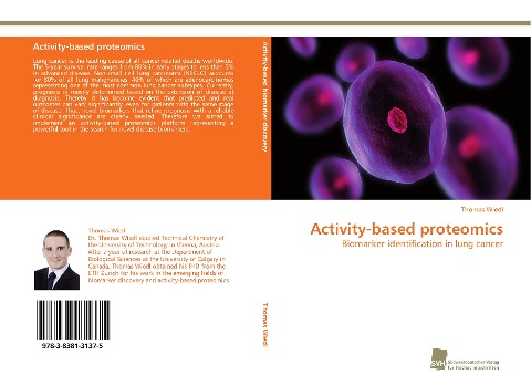 Activity-based proteomics: Biomarker identification in lung cancer