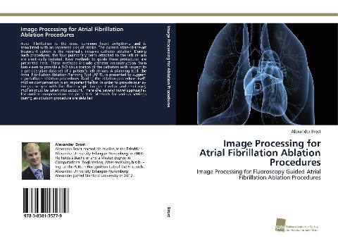 Image Processing for Atrial Fibrillation Ablation Procedures: Image Processing for Fluoroscopy Guided Atrial Fibrillation Ablation Procedures