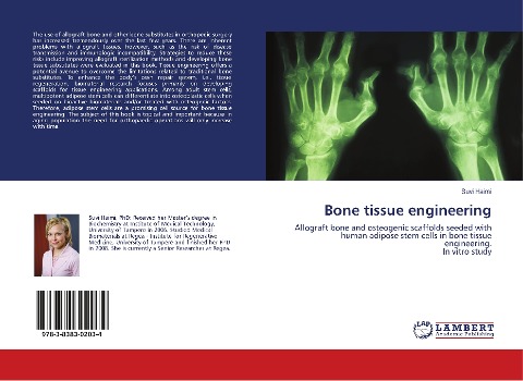 Bone tissue engineering: Allograft bone and osteogenic scaffolds seeded with human adipose stem cells in bone tissue engineering. In vitro study