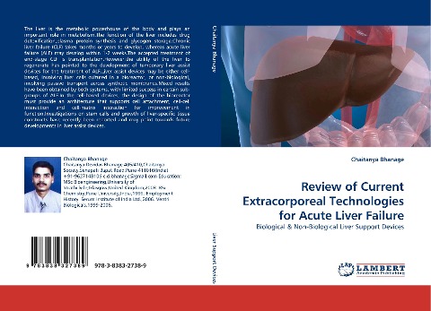 Review of Current Extracorporeal Technologies for Acute Liver Failure: Biological & Non-Biological Liver Support Devices
