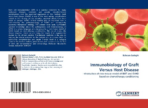 Immunobiology of Graft Versus Host Disease: Introduction of new mouse model of BMT and GVHD based on chemotherapy conditioning