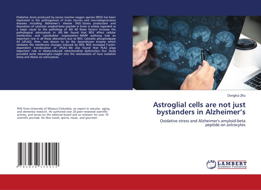 Astroglial cells are not just bystanders in Alzheimers: Oxidative stress and Alzheimers amyloid-beta peptide on astrocytes