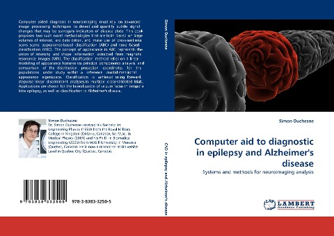Computer aid to diagnostic in ¿epilepsy and ¿Alzheimers disease: Systems and methods for neuroimaging analysis