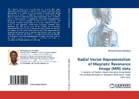 Radial Vector Representation of Magnetic Resonance Image (MRI) data: Simulation of Realistic Head Geometry Using Radial Vector Representation of Magnetic Resonance Image (MRI) data