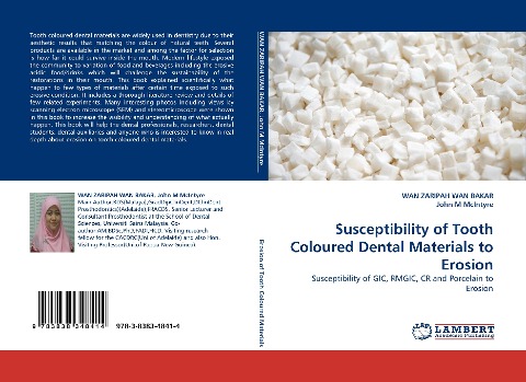 Susceptibility of Tooth Coloured Dental Materials to Erosion: Susceptibility of GIC, RMGIC, CR and Porcelain to Erosion