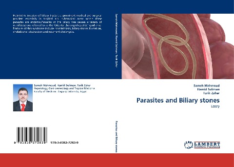 Parasites and Biliary stones: Essay