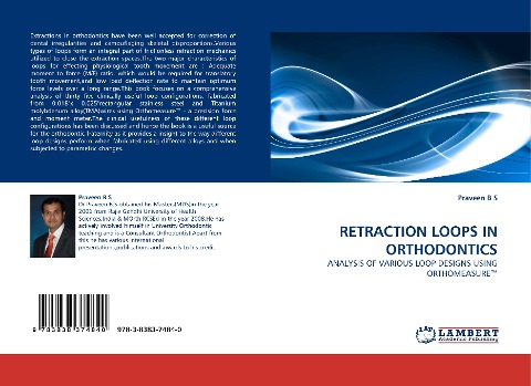 RETRACTION LOOPS IN ORTHODONTICS: ANALYSIS OF VARIOUS LOOP DESIGNS USING ORTHOMEASURE(TM)
