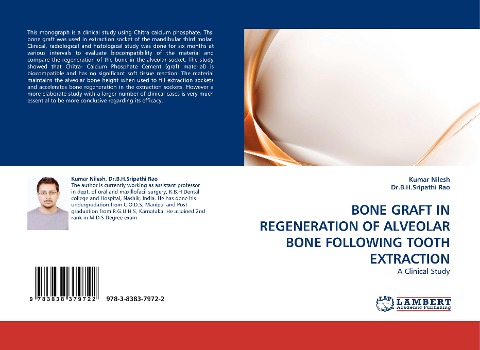 BONE GRAFT IN REGENERATION OF ALVEOLAR BONE FOLLOWING TOOTH EXTRACTION: A Clinical Study