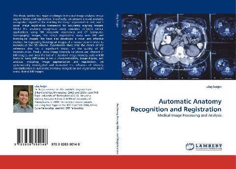 Automatic Anatomy Recognition and Registration: Medical Image Processing and Analysis
