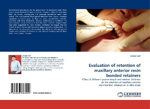 Evaluation of retention of maxillary anterior resin bonded retainers: Effect of different groove length and retainer thickness on the retention of maxillary anterior resin bonded retainers an in vitro study