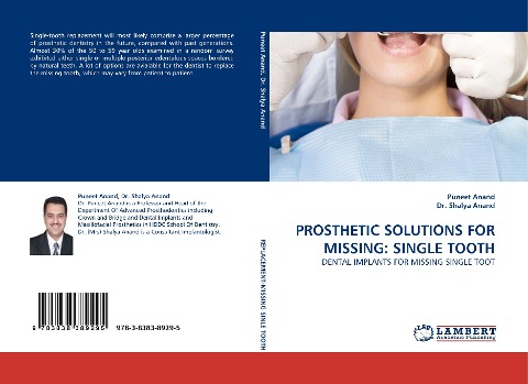 PROSTHETIC SOLUTIONS FOR MISSING: SINGLE TOOTH: DENTAL IMPLANTS FOR MISSING SINGLE TOOT