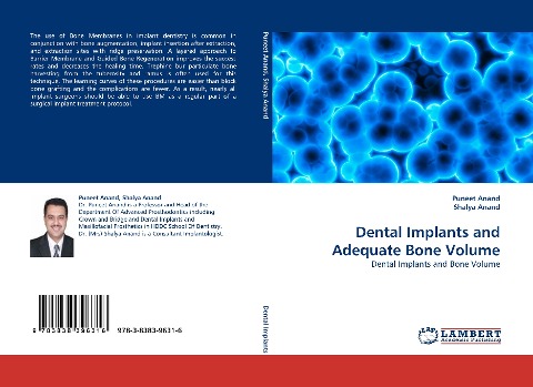 Dental Implants and Adequate Bone Volume: Dental Implants and Bone Volume