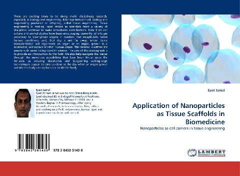Application of Nanoparticles as Tissue Scaffolds in Biomedicine: Nanoparticles as cell carriers in tissue engineering