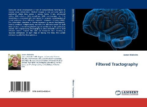 Filtered Tractography
