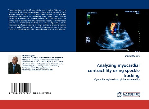 Analyzing myocardial contractility using speckle tracking: Myocardial regional and global contractility