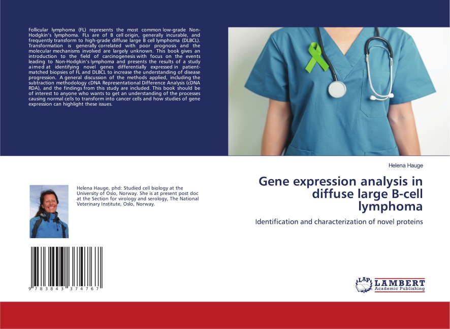 Gene expression analysis in diffuse large B-cell lymphoma: Identification and characterization of novel proteins