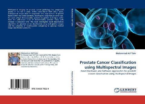 Prostate Cancer Classification using Multispectral Images: Novel Hardware and Software approaches for prostate cancer classification using Multispectral Images
