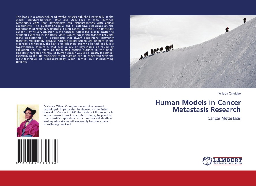 Human Models in Cancer Metastasis Research: Cancer Metastasis