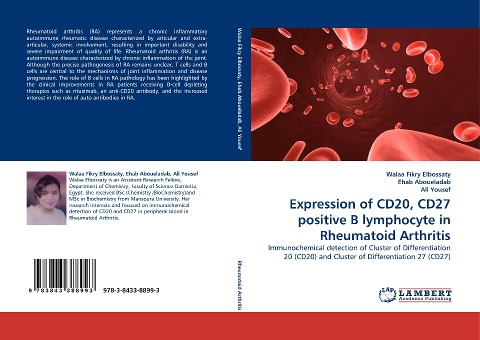Expression of CD20, CD27 positive B lymphocyte in Rheumatoid Arthritis: Immunochemical detection of Cluster of Differentiation 20 (CD20) and Cluster of Differentiation 27 (CD27)
