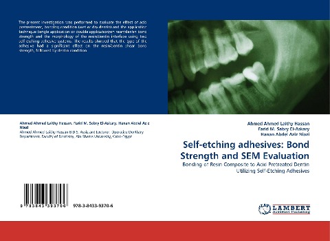 Self-etching adhesives: Bond Strength and SEM Evaluation: Bonding of Resin Composite to Acid Pretreated Dentin Utilizing Self-Etching Adhesives