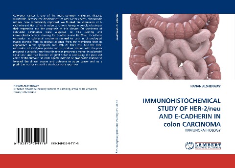 IMMUNOHISTOCHEMICAL STUDY OF HER-2/neu AND E-CADHERIN IN colon CARCINOMA: IMMUNOPATHOLOGY