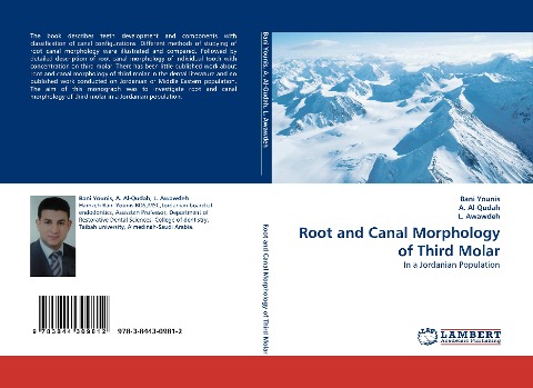 Root and Canal Morphology of Third Molar: In a Jordanian Population