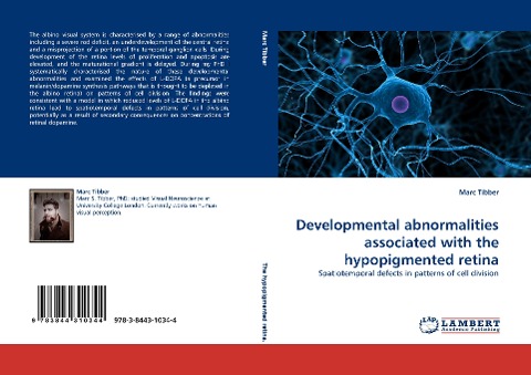 Developmental abnormalities associated with the hypopigmented retina: Spatiotemporal defects in patterns of cell division