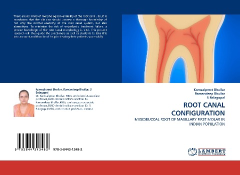 ROOT CANAL CONFIGURATION: MESIOBUCCAL ROOT OF MAXILLARY FIRST MOLAR IN INDIAN POPULATION