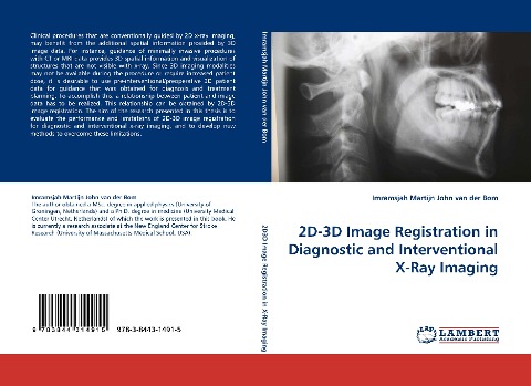 2D-3D Image Registration in Diagnostic and Interventional X-Ray Imaging