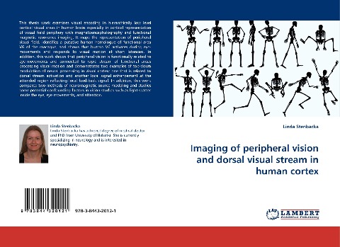 Imaging of peripheral vision and dorsal visual stream in human cortex