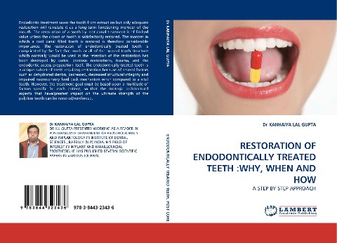 RESTORATION OF ENDODONTICALLY TREATED TEETH :WHY, WHEN AND HOW: A STEP BY STEP APPROACH