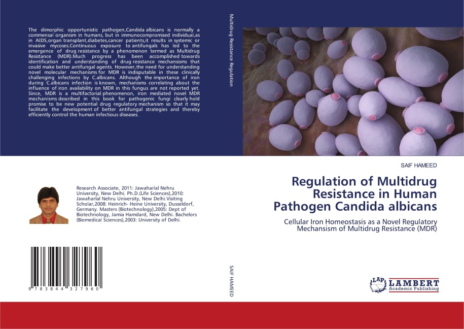Regulation of Multidrug Resistance in Human Pathogen Candida albicans: Cellular Iron Homeostasis as a Novel Regulatory Mechansism of Multidrug Resistance (MDR)