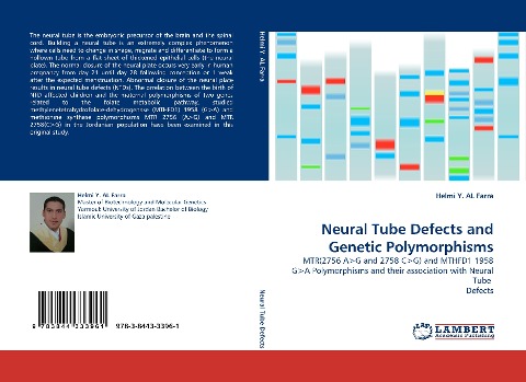 Neural Tube Defects and Genetic Polymorphisms: MTR(2756 A>G and 2758 C>G) and MTHFD1 1958 G>A Polymorphisms and their association with Neural Tube  Defects