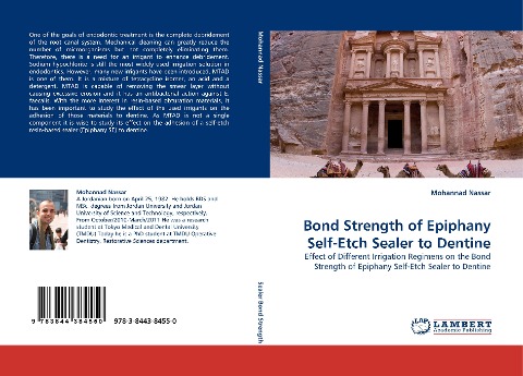 Bond Strength of Epiphany Self-Etch Sealer to Dentine: Effect of Different Irrigation Regimens on the Bond Strength of Epiphany Self-Etch Sealer to Dentine