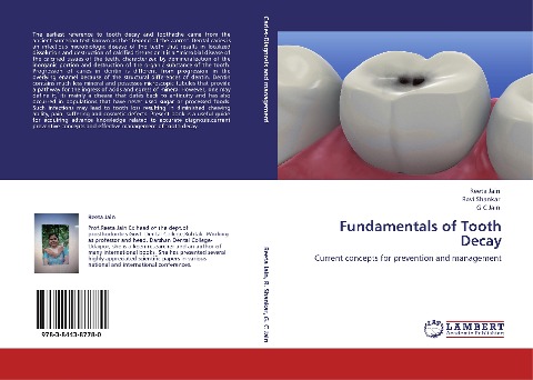 Fundamentals of Tooth Decay: Current concepts for prevention and management