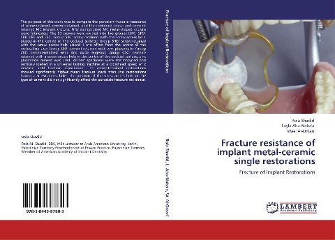 Fracture resistance of implant metal-ceramic single restorations: Fracture of Implant Restorations