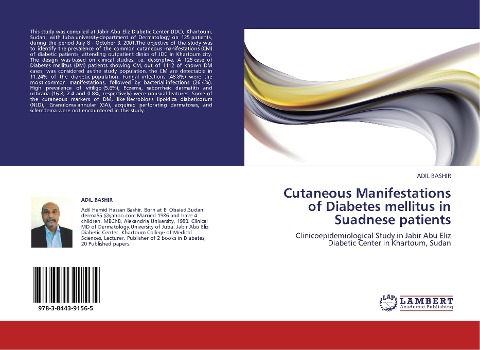 Cutaneous Manifestations of Diabetes mellitus in Suadnese patients: Clinicoepidemiological Study in Jabir Abu Eliz Diabetic Center in Khartoum, Sudan