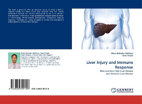 Liver Injury and Immune Response: Non-alcoholic Fatty Liver Disease and Alcoholic Liver Disease