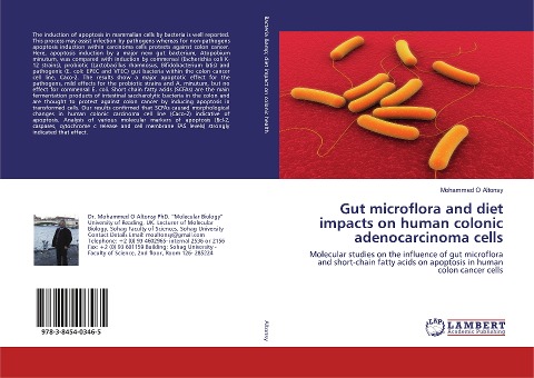 Gut microflora and diet impacts on human colonic adenocarcinoma cells: Molecular studies on the influence of gut microflora and short-chain fatty acids on apoptosis in human colon cancer cells