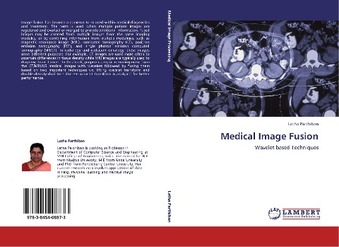 Medical Image Fusion: Wavelet based Techniques