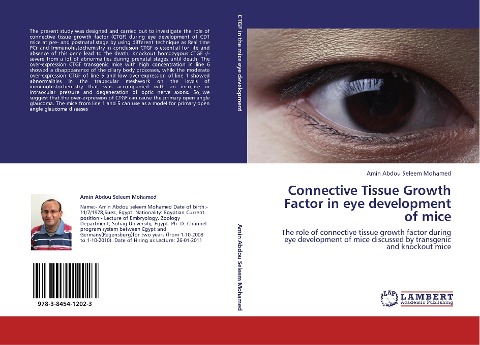 Connective Tissue Growth Factor in  eye development of mice: The role of connective tissue growth factor  during  eye development of mice discussed by transgenic and knockout mice