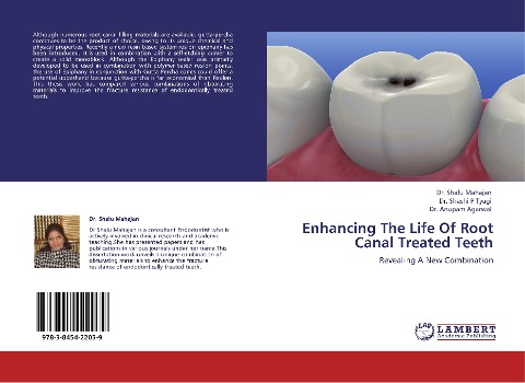 Enhancing The Life Of Root Canal Treated Teeth: Revealing A New Combination