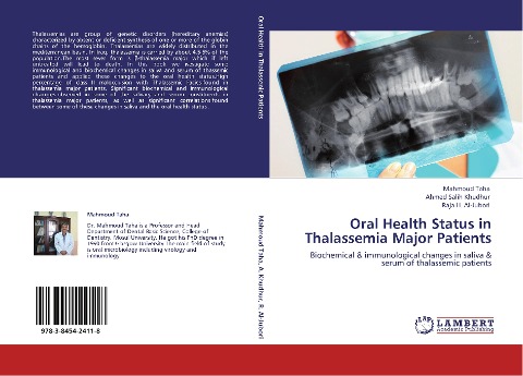 Oral Health Status in Thalassemia Major Patients: Biochemical & immunological changes in saliva & serum of thalassemic patients