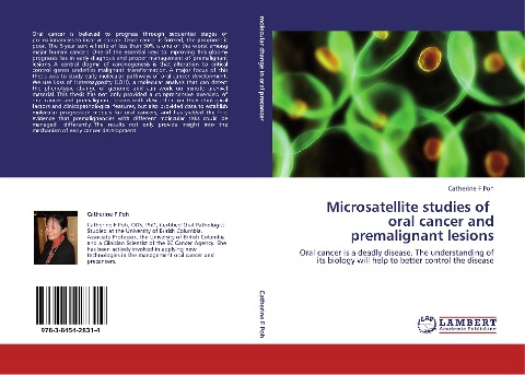 Microsatellite studies of oral cancer and premalignant lesions: Oral cancer is a deadly disease. The understanding of its biology will help to better control the disease