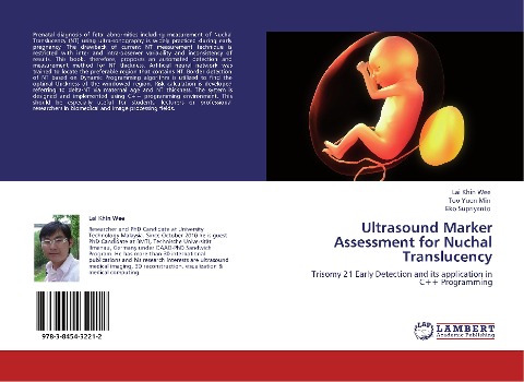 Ultrasound Marker Assessment  for Nuchal Translucency: Trisomy 21 Early Detection and its application in C++ Programming
